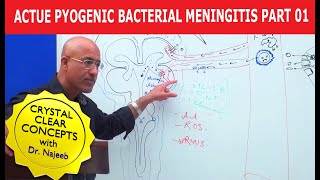 Acute Pyogenic Bacterial Meningitis Part 1 🩺 [upl. by Buyer]