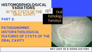 Histomorphological Variations in oral cysts part 2 Histopathology\Oral Pathology 360 Fundamentals [upl. by Sawyor]