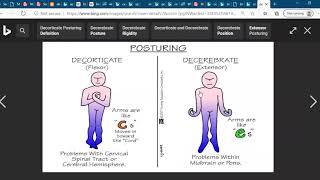 Decorticate and Decerebrate posturingNCLEX Exam Nursing Medical Student [upl. by Shafer]