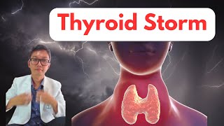 Thyroid storm  Doc Mar [upl. by Arica]