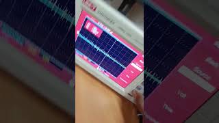 Power supply Noise and Ripple test [upl. by Cower712]