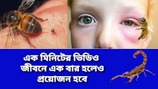 Honey Bee Bite Treatment  Honey Bee Bite Home Remedies  Bolta Moumachi Kamor Dile Koronio Bangla [upl. by Eniawtna]