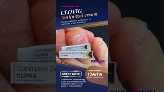 Clovig antifungal cream with Clotrimazole [upl. by Athalee]