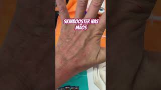 skinbooster biostimulador da Smartgr boosterpress [upl. by Lorusso]