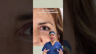 Resultado de blefaroplastia superior [upl. by Jule732]