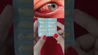 Chloramphenicol Eye Ointment Ip shorts eyeinfection viralshorts [upl. by Nathanial]