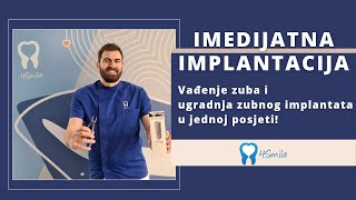 Imedijatna implantacija  Vađenje zuba i ugradnja zubnog implantata u jednoj posjeti [upl. by Modesta968]