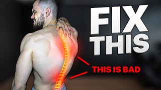 FIX your BROKEN POSTURE in Just 10 MinDay [upl. by Didier]