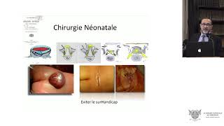 Le traitement chirurgical prénatal endoscopique du myéloméningocèle [upl. by Ringsmuth841]