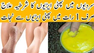 Remove Crack Heels In Over NightCracked Heels Home RemedyCrack Heels Cream [upl. by Adiehsar]