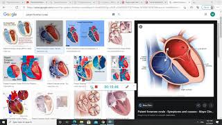 Respiratory physiology sheet 6  JU [upl. by Enihsnus]