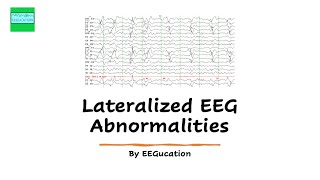 Lateralized EEG Abnormalities [upl. by Gladdie]