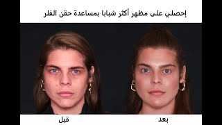 تجميل و تحديد الوجه  بحقن الفلر  رفع الحواجب  على المباشر مع أشهر دكتورة تجميل  ليلى أرفاس [upl. by Molton]