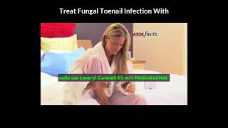 Pedicure Tutorial  Fungal toenail treatment amp Ingrown toenail removal Nails care [upl. by Aicatsanna184]