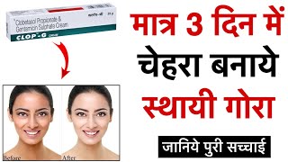 गोरे क्यों हो रहे है लोग ये क्रीम Use करके  Clop  G Cream Review  Clop G cream Usages amp Benefits [upl. by Novyar]