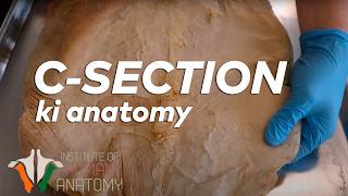 CSection ki Anatomy in Hindi [upl. by Stoll308]