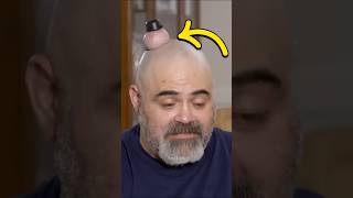 This man had a lump on his head 😨 Part  2 facts shorts [upl. by Curzon]