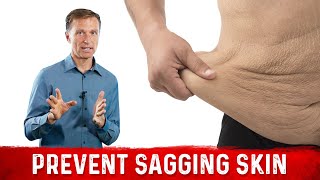 How To Prevent Sagging Skin with Losing Weight – DrBerg On Loose Skin After Weight Loss [upl. by Baggott]