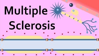 Multiple Sclerosis and the Myelin Sheath [upl. by Gavin]