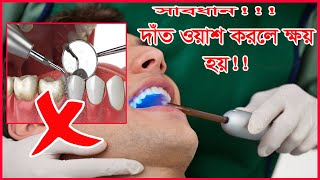 দাঁত ওয়াশ করলে কি ক্ষতি হয় । tooth scaling and polishing । দাঁত স্কেলিং কিভাবে করে । dentshanto [upl. by Onitnas194]