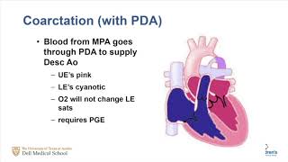 Approach To The Infant With Cyanotic Congenital Heart Disease [upl. by Asiral]