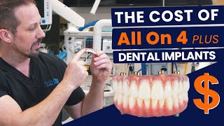 True Cost of All On 4 Plus® Dental Implants [upl. by Strawn]