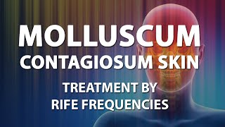 Molluscum Contagiosum Skin  RIFE Frequencies Treatment  Energy amp Quantum Medicine Bioresonance [upl. by Jollanta142]