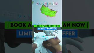 Affordable Teeth Aligners Treatment In Hyderabad  Invisible Aligners Braces  Smile Makeover [upl. by Ullman]