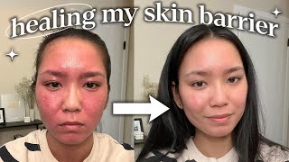 how i repaired my skin barrier not sponsored [upl. by Christis]