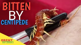 Floridas Giant centipede bite [upl. by Refannej233]