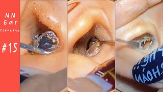 Impacted Ear Wax RemovalEP15  NN Ear cleaning [upl. by Airuam955]