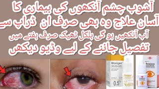 Moxigan amp femicon eye drops uses in urdu l best for eyes infection and itching by aneespharmacist [upl. by Kent608]