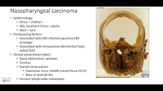 Nasopharynx Nasopharyngeal carcinoma Gross pathology [upl. by Eilesor]