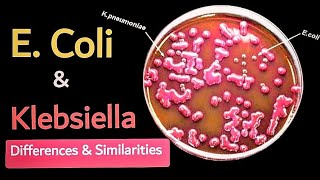 Difference between E coli and Klebsiella 🧫 lactose fermentor enterobacteriaece 🔬 [upl. by Nelda]