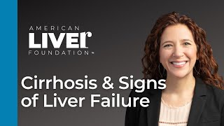 Progression of Liver Disease Webcast Series Cirrhosis and Signs of Liver Failure [upl. by Reppep]