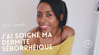 Comment jai soigné ma dermite séborrhéique [upl. by Yantruoc]