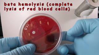 Streptococcus pyogenes on Blood Agar with a Taxo A Disc [upl. by Eipper]