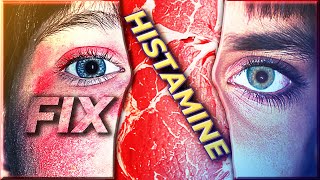 How I fixed my Histamine Intolerance [upl. by Cassidy]