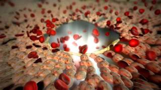 Medical Animation  Hepatic [upl. by Vivian]