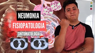 FISIOPATOLOGIA de la NEUMONIA  FASES de la NEUMONIA y SINTOMATOLOGIA  Anatomia [upl. by Miett]