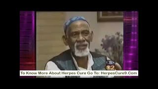 Dr Sebi On Herpes Cure  Natural Cure For Herpes By Dr Sebi [upl. by Fusuy]