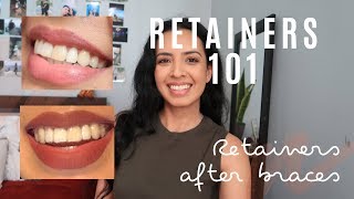 RETAINERS 101  THINGS to KNOW  TEETH LIFE after getting my braces taken off [upl. by Llertnahs]