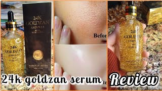 24k Goldzan Serum Review Price  Benefits Side effects [upl. by Allix]