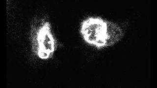 Nuclear Envelope Reassembly in vivo [upl. by Dorsman681]