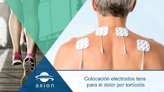 Colocación electrodos TENS para dolor de tortícolis  Electroestimulación TENS para terapia de dolor [upl. by Previdi]