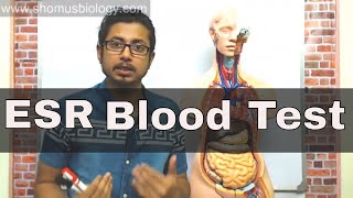 ESR test in Hindi erythrocyte sedimentation rate test [upl. by Pillow496]