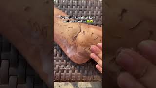 Deep Cleansing Remove Dust and Dead Skin ameenbeautytips [upl. by Reyna17]