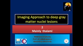 thalamic lesions [upl. by Schell]