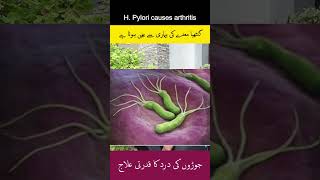 WARNING H Pylori Infection Could Be CAUSING Your Arthritis arthritis hpylori guthealth [upl. by Aikyn]