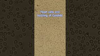 Yeast cells and budding of Candida [upl. by Yralih]